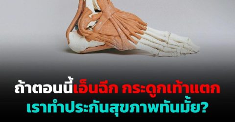 ถ้าตอนนี้เอ็นฉีก กระดูกเท้าแตก เราทำประกันสุขภาพทันมั้ย?